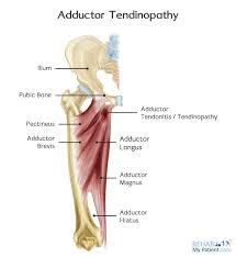 The groin is the area that lies between the abdomen stomach and thighs. Adductor Tendinopathy An Athlete S Struggle With Groin Pain Diversified Integrated Sports Clinicdiversified Integrated Sports Clinic