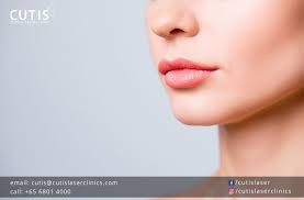 lip fillers not just for thin lips
