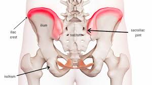 iliac crest pain syndrome causes and