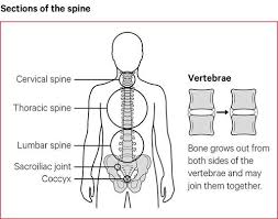 As a nurse, you will need to know the basic about the human skeleton. Ankylosing Spondylitis Symptoms Causes Treatments