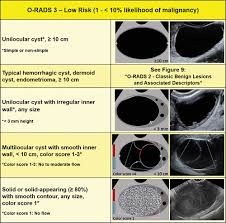 Around ovulation, the follicle measures around 2 cm, so this is a little bigger. O Rads Us Risk Stratification And Management System A Consensus Guideline From The Acr Ovarian Adnexal Reporting And Data System Committee Radiology