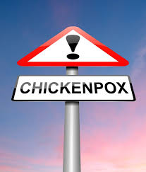 The Chicken Pox Diet Eat Drink Live Well