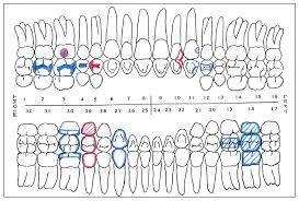 Dental Charting Practice Sheets Best Picture Of Chart