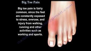 big toe pain everything you need to