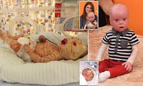 A chronic, congenital ichthyosis inherited as an autosomal recessive trait. Housebound Boy Two Is Mistaken For A Doll Because Of A Rare Condition Daily Mail Online