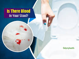 blood in your stool
