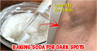 how to use baking soda for dark spots