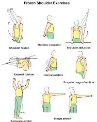 Some causes of shoulder pain are over exercising, overthrowing, having improper posture, stress, your lifestyle, lack of nutrients, etc. Shoulder Stretches Frozen Shoulder Treatment Frozen Shoulder Frozen Shoulder Exercises