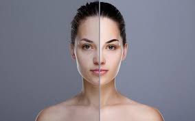 uneven skin tone causes treatment