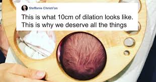 This Dilation Chart Helps People Understand That Giving