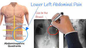 pain in lower left abdomen low