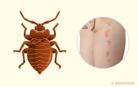 Ухапванията от дървеници обикновено приличат на ухапвания от други насекоми, включително ухапвания от комари. 10 Uhapvaniya Ot Nasekomi Koito Vseki Bi Tryabvalo Da Mozhe Da Identificira Snimki Petel Bg