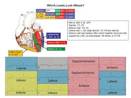 12 Lead Diagram Septal 12 Lead Placement Relationship Of 12
