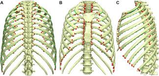 Look for clues from landmarks and muscle attachments that will tell you exactly where the rib cage is. Association Between Ribs Shape And Pulmonary Function In Patients With Osteogenesis Imperfecta Sciencedirect