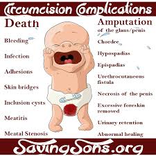 Peaceful Parenting Death From Circumcision