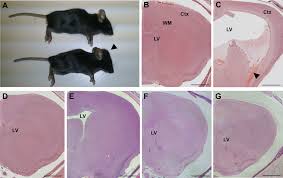 hydrocephalus in cfap54 gt gt mice a