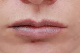 bruised lips from kissing top tips to