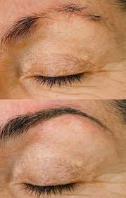 permanent makeup before afters