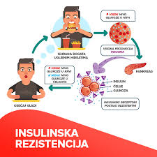 insulinska rezistencija sve što je
