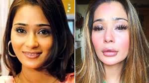 sara khan trolled for plastic surgery