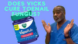 does vicks cure toenail fungus you