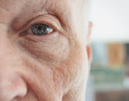 Image result for wrinkle on face