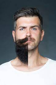 why some men cannot grow a beard explained