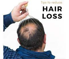 7 ways to prevent hair loss healthsprings