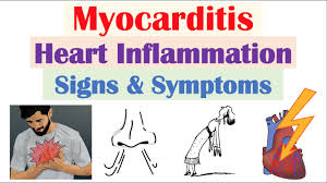 myocarditis heart inflammation signs