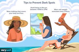 dark spots causes diagnosis and