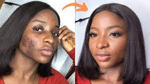 acne coverage makeup tutorial for dark