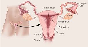 A condition in which cells from the lining of the uterus grow outside the uterus: If You Have Endometrial Cancer