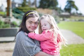 It affects about 1 in 700 babies. Vancouver Island Down Syndrome Society Offers Support For Families In The Community Saanich News