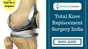 total knee replacement surgery india