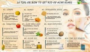 any home remis for pimple scars