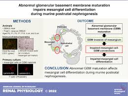Abnormal Glomerular Basement Membrane