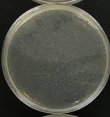 128 questions with answers in lb agar