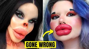 plastic surgery went horribly wrong