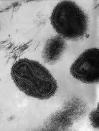 Smallpox and chickenpox might seem similar. Orthopoxviruses Variola Vaccinia Cowpox And Monkeypox Springerlink