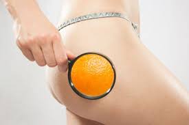 Risultati immagini per cellulite