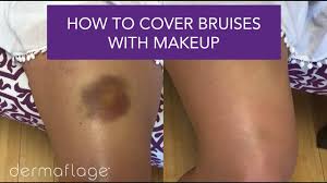leg bruise makeup