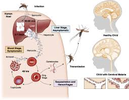 Malaria is a serious tropical disease spread by mosquitoes. Desperately Seeking Therapies For Cerebral Malaria The Journal Of Immunology