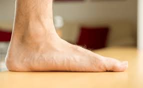 can having flat feet cause back problems
