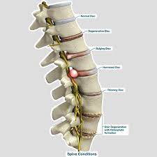Spine Conditions Labeled Chart