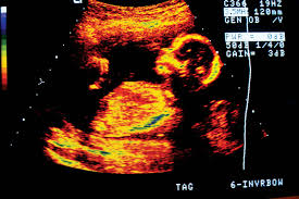Prenatal Development Physiology Britannica