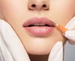 reduce lip filler swelling and bruising