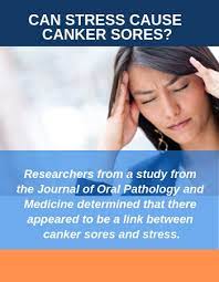 stress and canker sores are canker