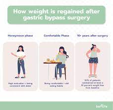 weight gain after gastric byp what