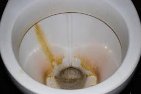 Hard Water Stains In Your Toilet