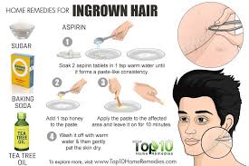home remes for ingrown hair top 10